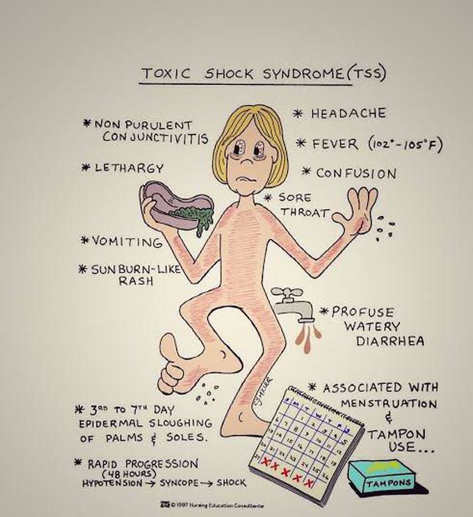 Toxic Shock Syndrome