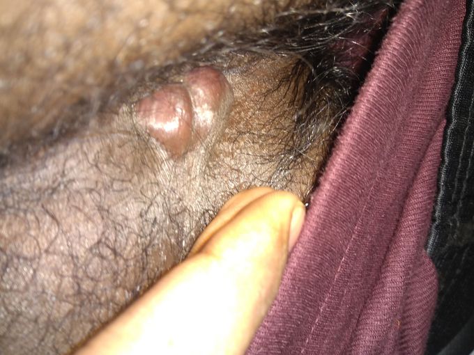 Diagnosis and treatment?