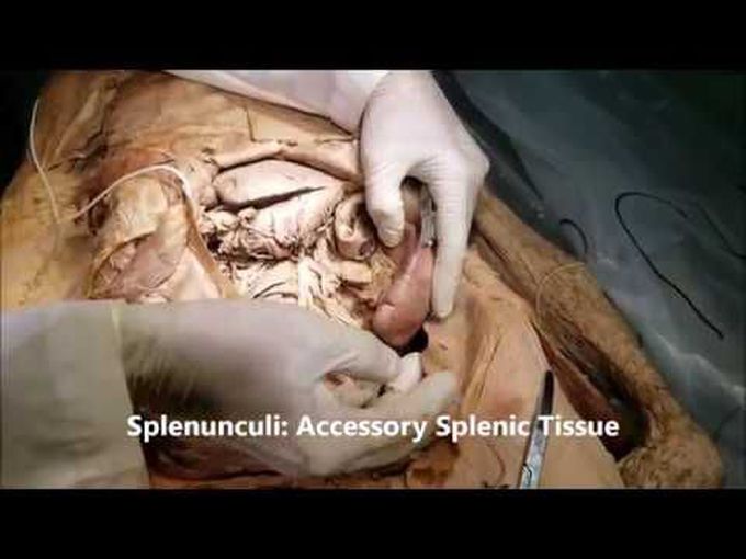 Morphology, Ligaments and Blood Vessels of Spleen