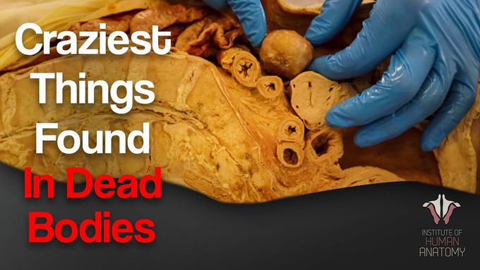 5 Craziest Things inside the Dead Bodies