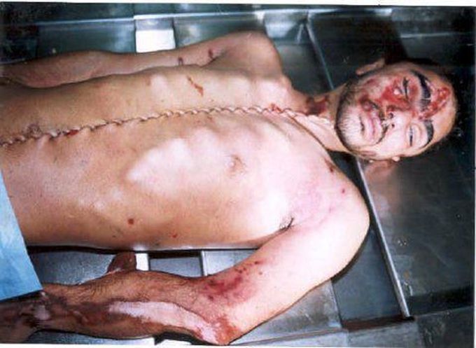 Postmortem