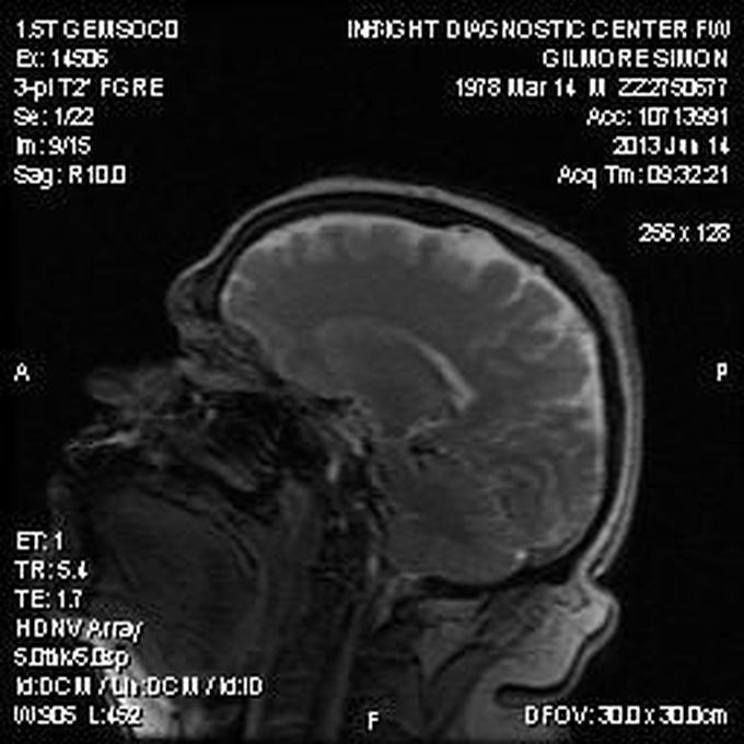 my amazing brain - MEDizzy