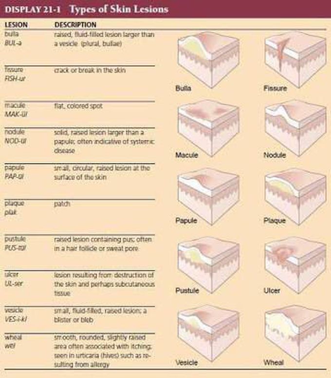 Types of skin lesions - MEDizzy