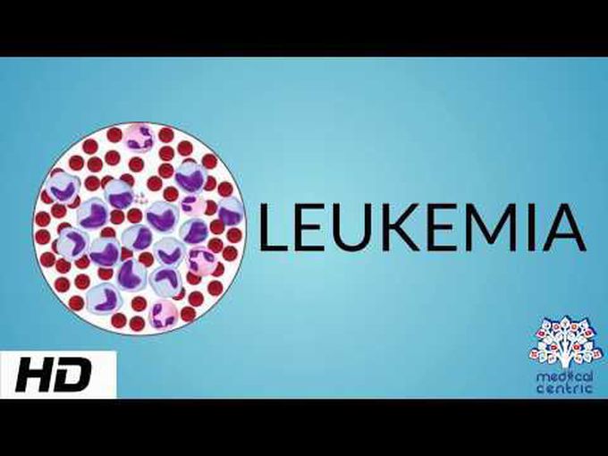 Overview of Leukemia