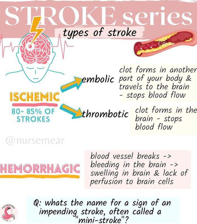 Types of Stroke