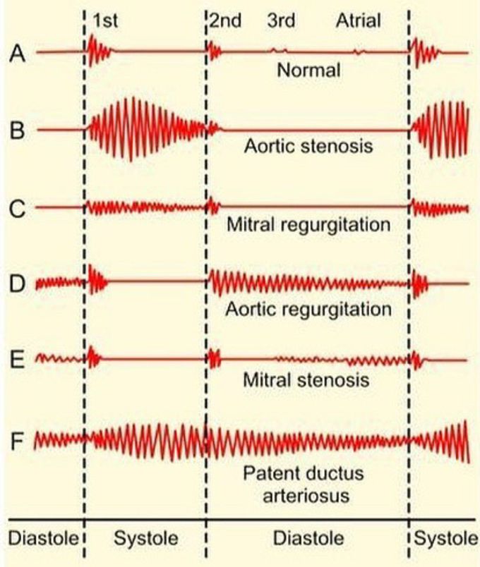 Cardiology