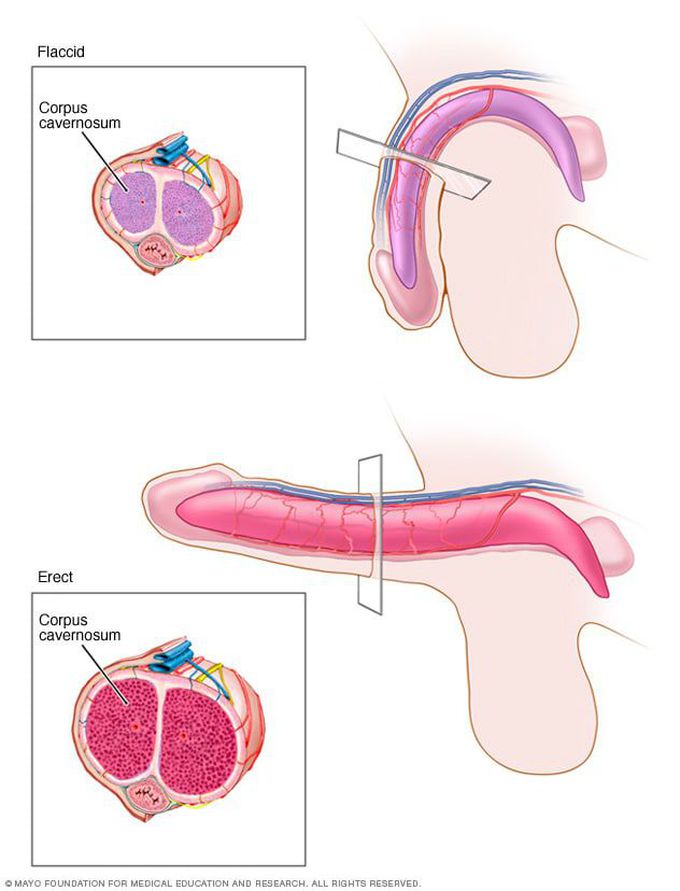 Erectile dysfunction