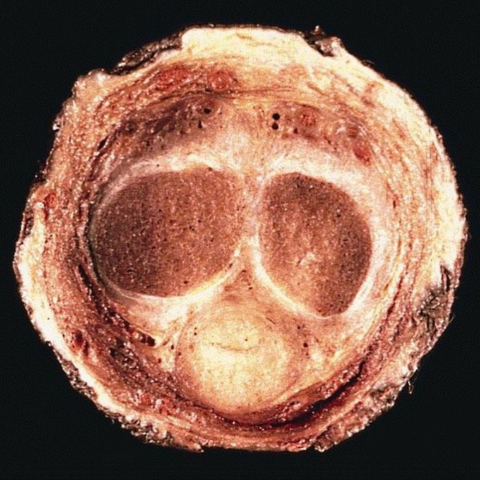 Cross section of the Penis