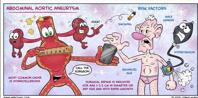 Abdominal aortic aneurysm