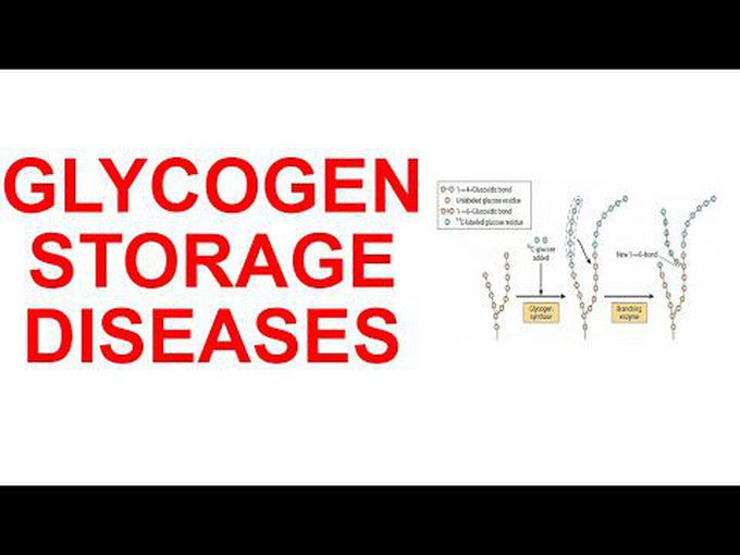 Glycogen Metabolism- Glycogen Storage Diseases