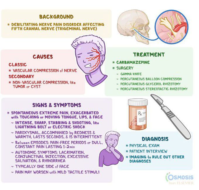 Trigeminal neuralgia