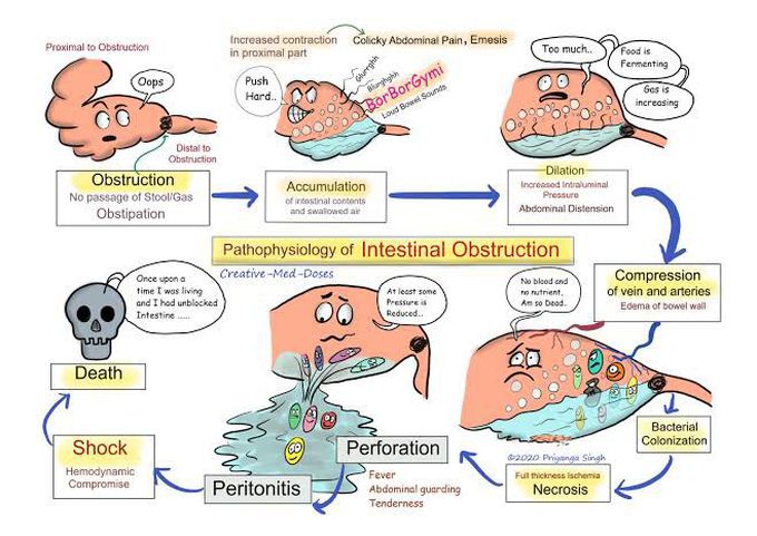 Pathophysiology of intestinal Obstruction