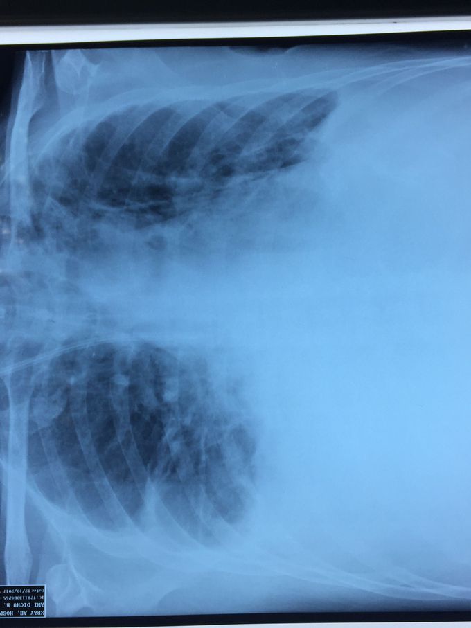 Guess the diagnosis