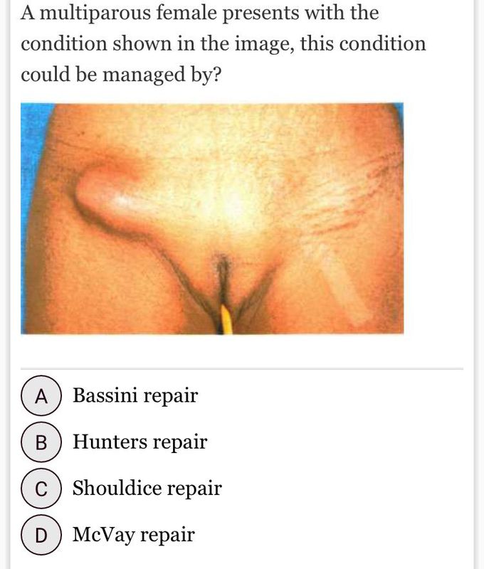 What’s the Answer Guys ???