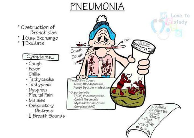 Pneumonia