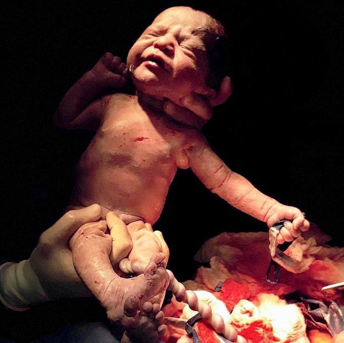 Beautiful photo taken just a few moments after the delivery. 