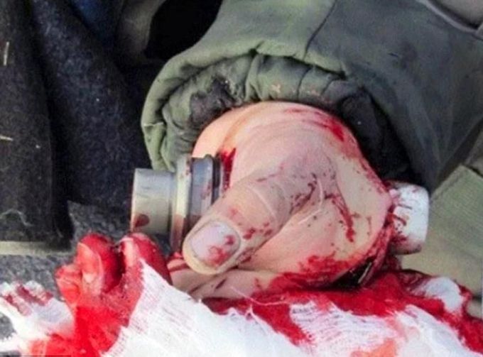 Grenade in the hand