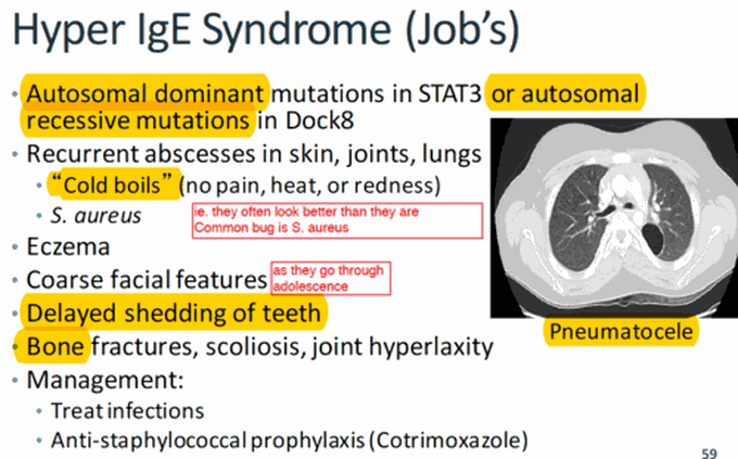 Job's syndrome