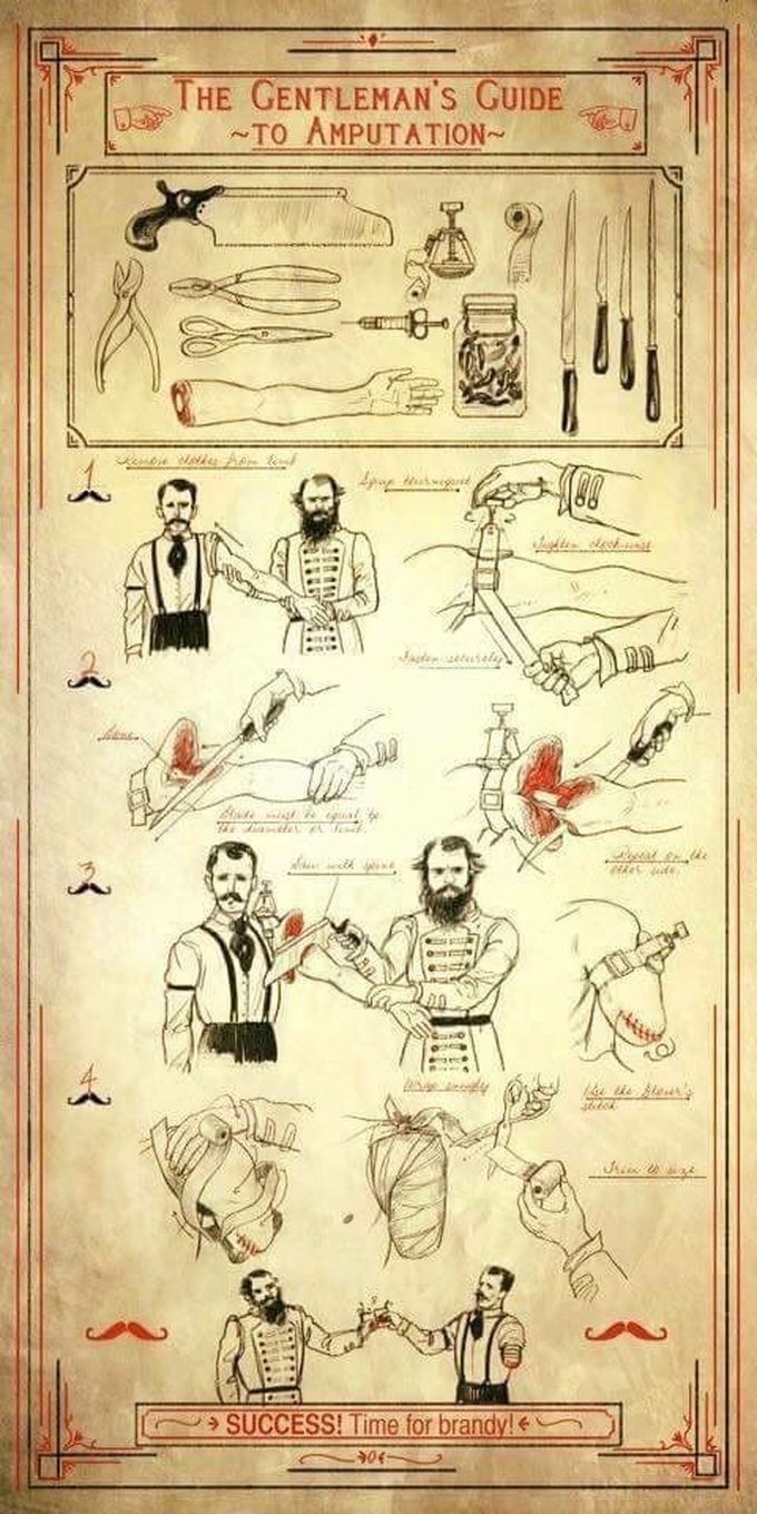 #Amputation #throwback