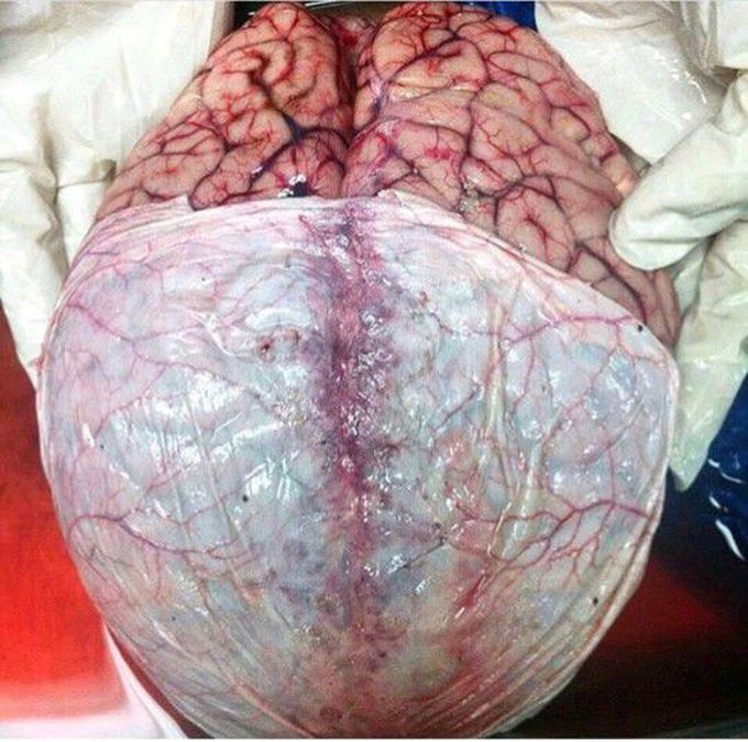 Brain
