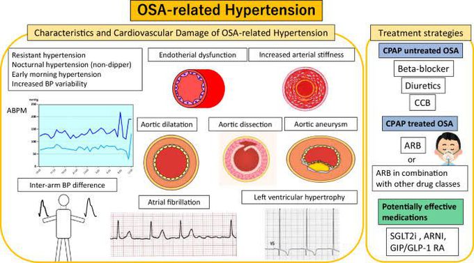 OSA related Hypertension