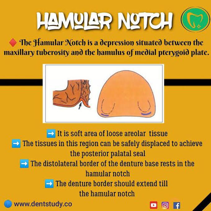 Hamular Notch