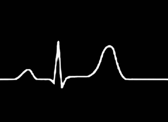 🔸 Guess the diagnosis !!