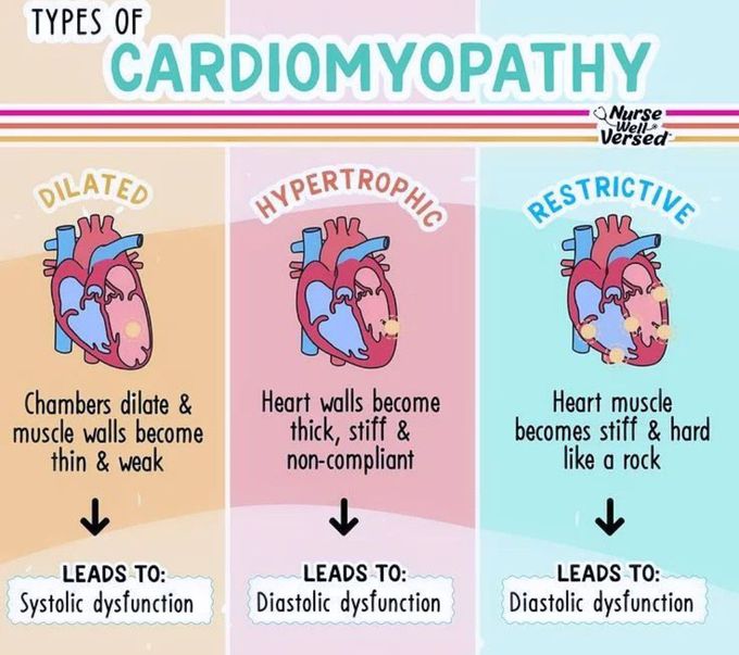 Types of Cardiomyopathy