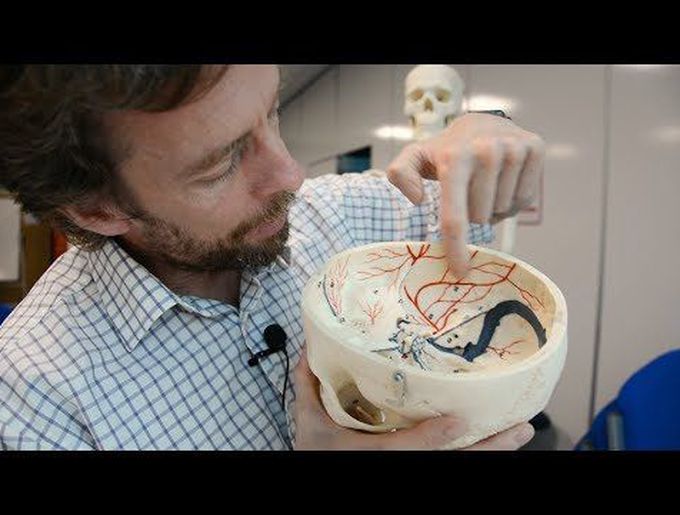 Middle meningeal artery (& extradural haematoma, or why a blow to the side of the head can kill)