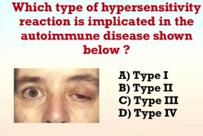 Identify the Hypersensitivity