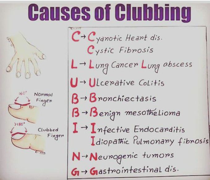 Causes of clubbing