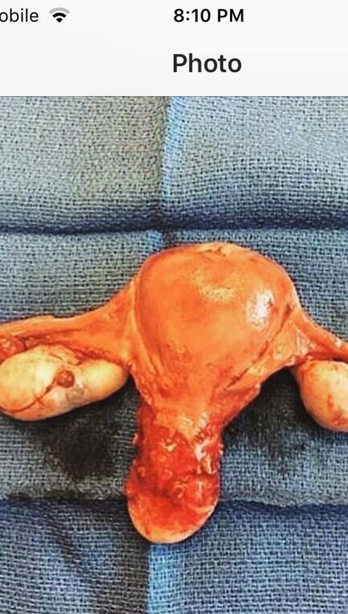 Great shot showing female organs