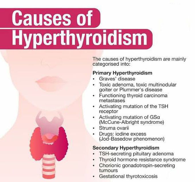 These are the causes of Hyperthroidism