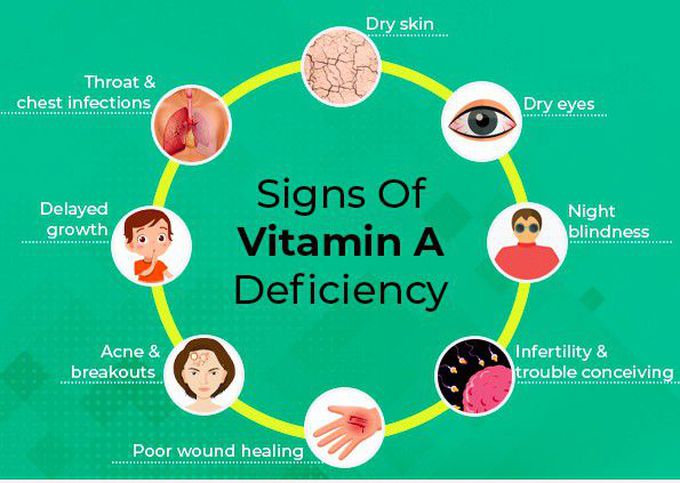 managing-vitamin-d-deficiency-in-inflammatory-bowel-disease-frontline