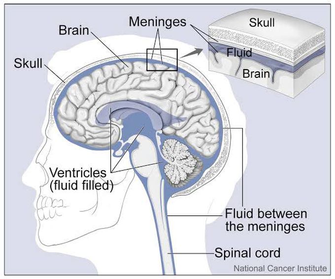 Aseptic meningitis