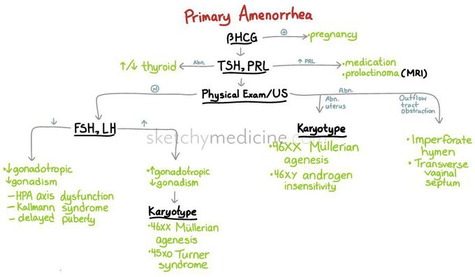 Primary Amenorrhea workup & DD - MEDizzy