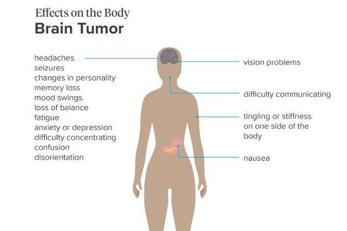 Following are the effects of the brain tumor