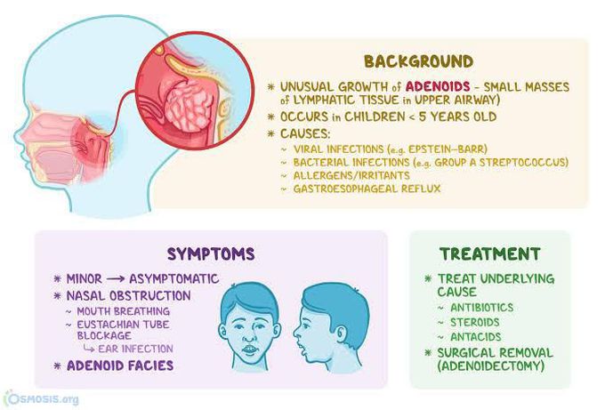 Adenoid treatment