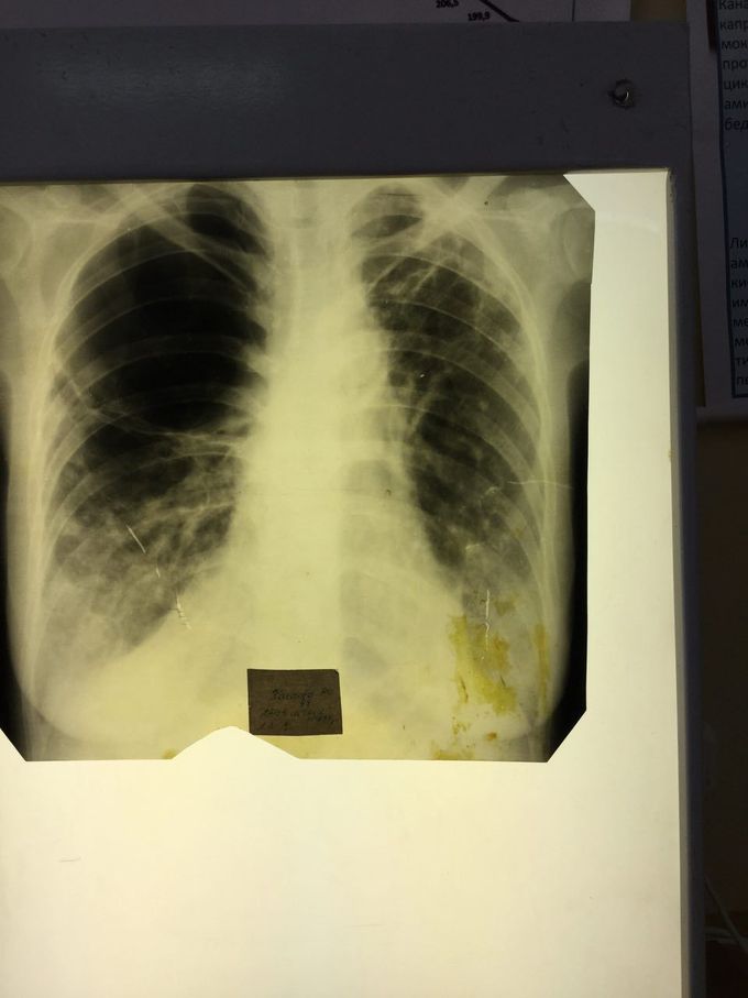 Diagnosis?