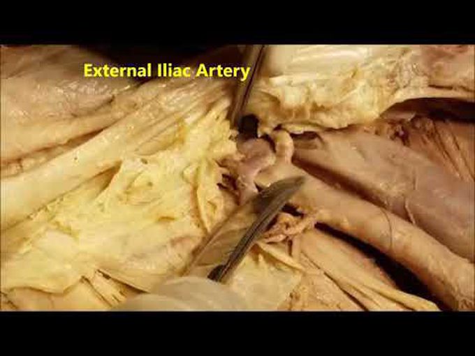 Dissection of Rectus Sheath and Rectus Abdominis Muscle