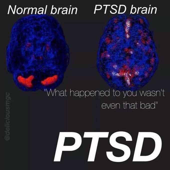 If only they could see what's inside the brain of a PTSD patient...