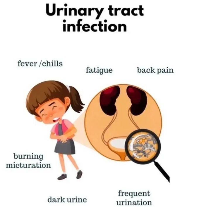 Urinary Tract Infections MEDizzy