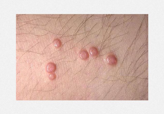 Spot the medical diagnosis