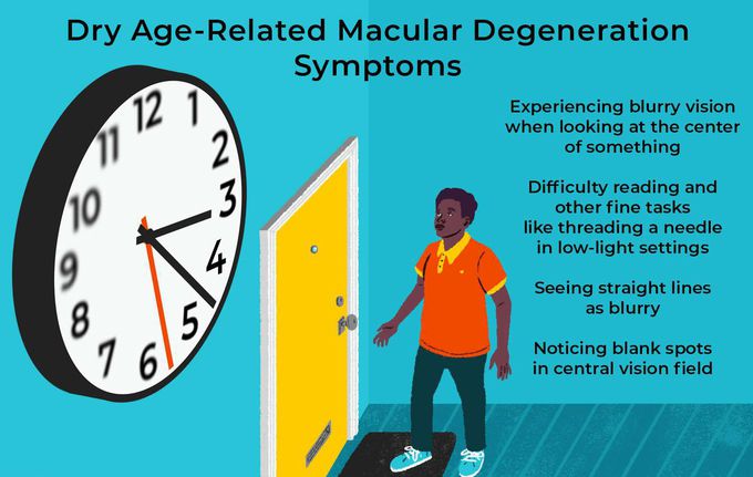 Symptoms of Dry Macular Degeneration