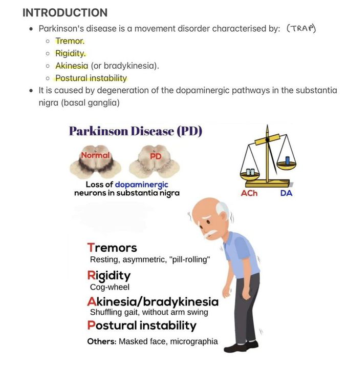 Bronchiectasis VIII