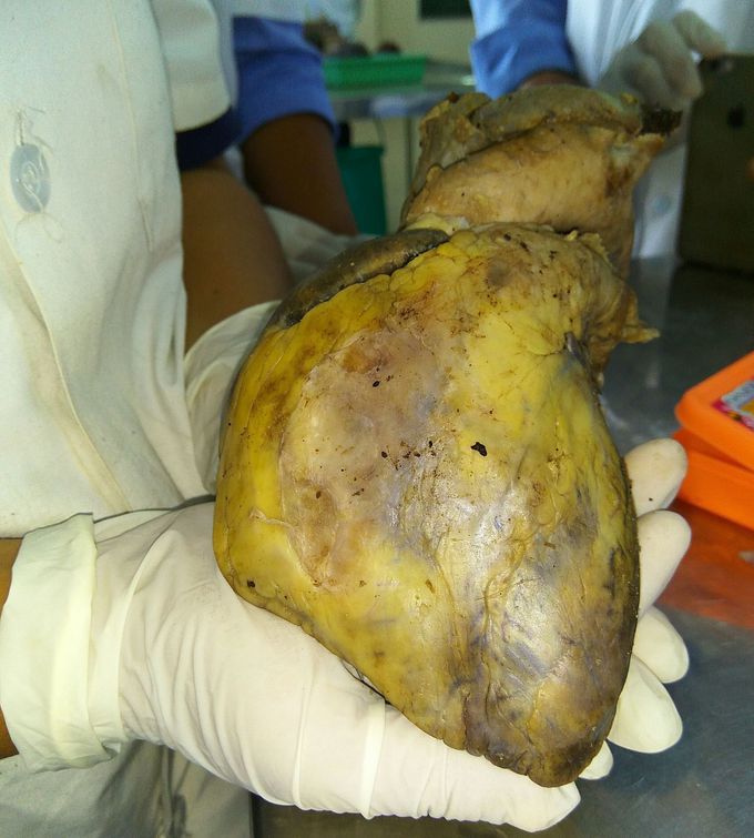 Dissection....