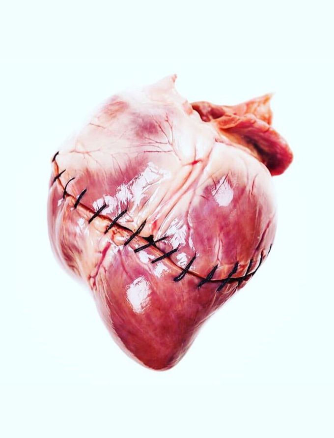 Human heart with a beauty suturing❤️
