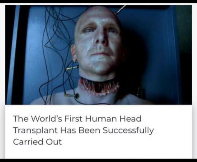 World's First Human Head Transplant