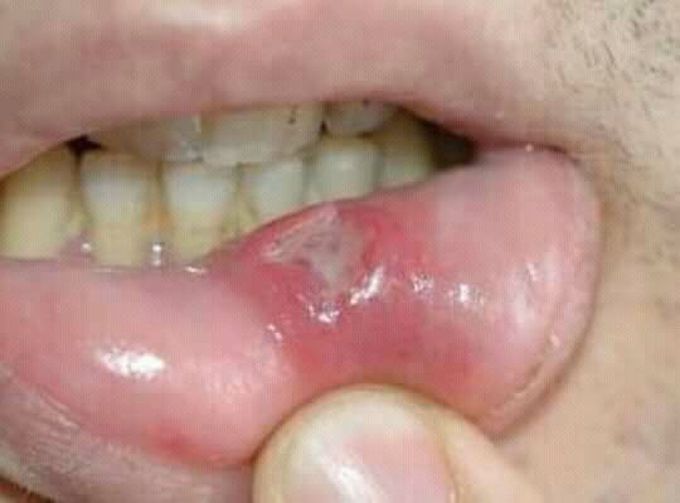 Which.drug or used for these......