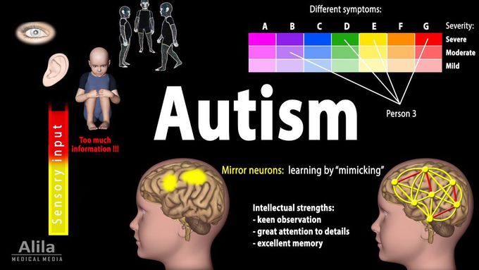 Autism Spectrum (Animation)